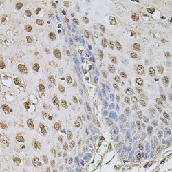 Cyclin-A2 (CCNA2) Antibody
