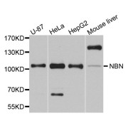 Western blot analysis of extracts of various cell lines, using NBN antibody (abx007234) at 1/1000 dilution.