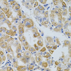 Proprotein Convertase Subtilisin/Kexin Type 9 (PCSK9) Antibody