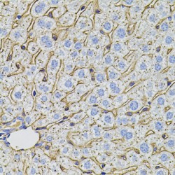 Proprotein Convertase Subtilisin/Kexin Type 9 (PCSK9) Antibody