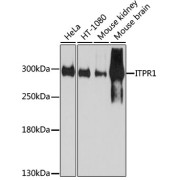 Western blot analysis of extracts of various cell lines, using ITPR1 antibody (abx007237) at 1/1000 dilution.