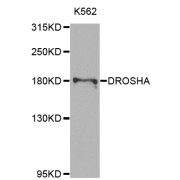 Western blot analysis of extracts of K-562 cells, using DROSHA antibody (abx007241) at 1/1000 dilution.