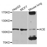 Western blot analysis of extracts of various cell lines, using ACE antibody (abx007261) at 1/1000 dilution.