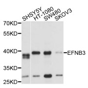 Western blot analysis of extracts of various cell lines, using EFNB3 antibody (abx007278) at 1/1000 dilution.