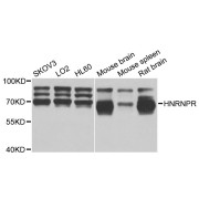 Western blot analysis of extracts of various cell lines, using HNRNPR antibody (abx007306) at 1/1000 dilution.