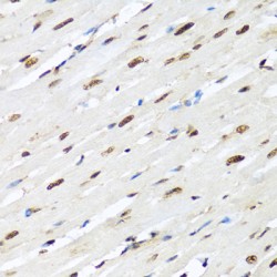 Heterogeneous Nuclear Ribonucleoprotein R (HNRNPR) Antibody