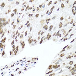 Heterogeneous Nuclear Ribonucleoprotein R (HNRNPR) Antibody