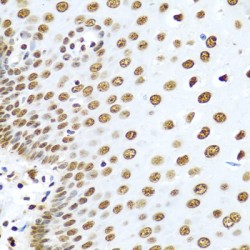 Heterogeneous Nuclear Ribonucleoprotein R (HNRNPR) Antibody