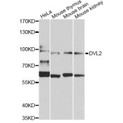 Western blot analysis of extracts of various cell lines, using DVL2 Antibody (abx007310) at 1/1000 dilution.