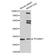 Western blot analysis of extracts of various cell lines, using TP53INP1 antibody (abx007314) at 1/1000 dilution.