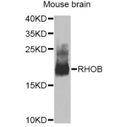 Western blot analysis of extracts of mouse brain, using RHOB Antibody (abx007320) at 1/1000 dilution.