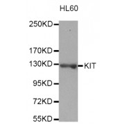 Western blot analysis of extracts of HL-60 cells, using KIT antibody (abx007343).