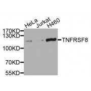 Western blot analysis of extracts of various cell lines, using TNFRSF8 antibody (abx007347) at 1/1000 dilution.