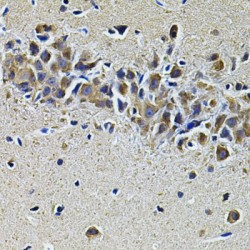 Phospholipase C Gamma 1 (PLCG1) Antibody