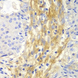 Filamin-A (FLNA) Antibody