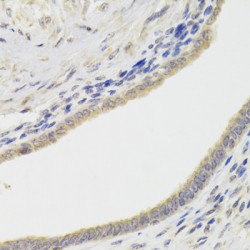 Histone Deacetylase 4 (HDAC4) Antibody