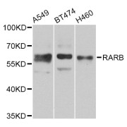 Western blot analysis of extracts of various cell lines, using RARB Antibody (abx007368) at 1/1000 dilution.