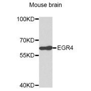 Western blot analysis of extracts of mouse brain, using EGR4 antibody (abx007379).