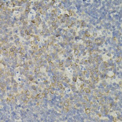 Interferon Regulatory Factor 1 (IRF1) Antibody