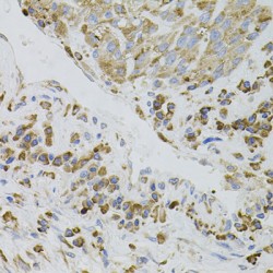 Interferon Regulatory Factor 1 (IRF1) Antibody