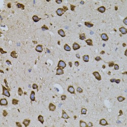 Interferon Regulatory Factor 1 (IRF1) Antibody