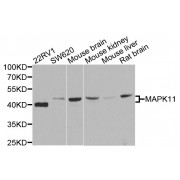 Western blot analysis of extracts of various cell lines, using MAPK11 antibody (abx123032) at 1/500 dilution.