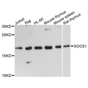 Western blot analysis of extracts of various cell lines, using SOCS1 antibody (abx123037) at 1:3000 dilution.