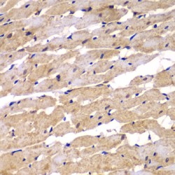 Presenilin 2 (PSEN2) Antibody