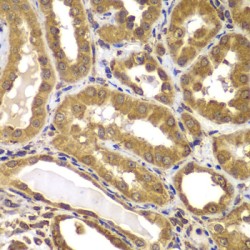 Presenilin 2 (PSEN2) Antibody