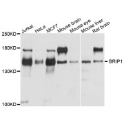 Western blot analysis of extracts of various cell lines, using BRIP1 antibody (abx123075) at 1/1000 dilution.