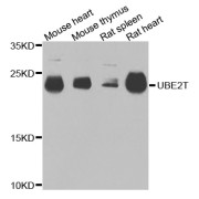 Western blot analysis of extracts of various cell lines, using UBE2T antibody (abx123104) at 1/1000 dilution.