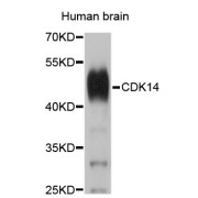 Western blot analysis of extracts of human brain, using CDK14 antibody (abx123116).