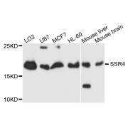 Western blot analysis of extracts of various cell lines, using SSR4 antibody (abx123144) at 1/1000 dilution.