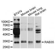 Western blot analysis of extracts of various cell lines, using RAB35 antibody (abx123176) at 1/1000 dilution.