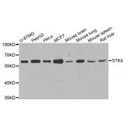 Western blot analysis of extracts of various cell lines, using STK4 antibody (abx123177) at 1/1000 dilution.