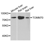 Western blot analysis of extracts of various cell lines, using TOMM70 antibody (abx123182) at 1/1000 dilution.