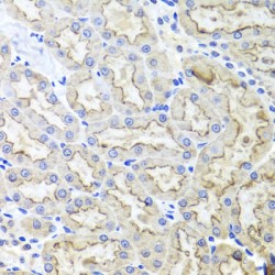 Low Density Lipoprotein Receptor Related Protein 2 (LRP2) Antibody