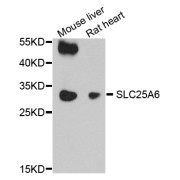 Western blot analysis of extracts of various cell lines, using SLC25A6 antibody (abx123248) at 1/1000 dilution.