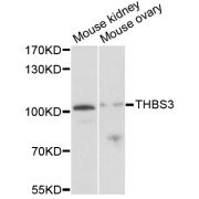 Western blot analysis of extracts of various cell lines, using THBS3 antibody (abx123257) at 1/1000 dilution.