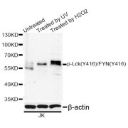 Western blot analysis of extracts of Jurkat cells, using Phospho-Lck-Y416/FYN-Y416 antibody (abx123276) at 1/1000 dilution. Jurkat cells were treated by UV for 15-30 minutes or treated by Hydrogen Peroxide (2mM) for 2 minutes after serum-starvation overnight.