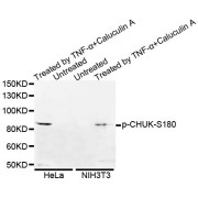 Western blot analysis of extracts of various cell lines, using Phospho-CHUK-S180 antibody (abx123283).