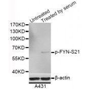 Western blot analysis of extracts of A-431 cells, using Phospho-FYN-S21 antibody (abx123287) at 1/1000 dilution. HL-60 cells were treated by 10% FBS after serum-starvation overnight.