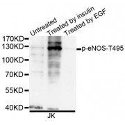 Western blot analysis of extracts of JK cells, using Phospho-eNOS-T495 antibody (abx123293).