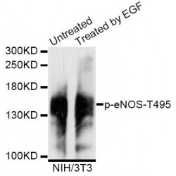 NOS3 (pY495) Antibody
