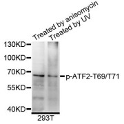 Western blot analysis of extracts of 293T cells, using Phospho-ATF2-T69/T71 antibody (abx123298) at 1/1000 dilution.