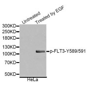 Western blot analysis of extracts of various cell lines, using Phospho-FLT3-Y589/591 antibody (abx123302).