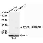 Western blot analysis of extracts of 293 cells, using Phospho-MAP2K4-S257/T261 antibody (abx123307) at 1/1000 dilution. 293 cells were treated by UV for 15-30 minutes.