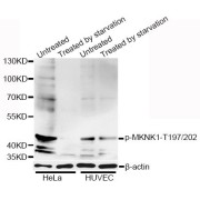 Western blot analysis of extracts of HeLa and HUVEC cells, using Phospho-MKNK1-T197/202 antibody (abx123308) at 1/1000 dilution. HeLa cells were treated by serum-starvation overnight. HUVEC cells were treated by serum-starvation overnight.