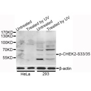 Western blot analysis of extracts of HeLa and 293 cells, using Phospho-CHEK2-S33/35 antibody (abx123309) at 1/1000 dilution. HeLa cells were treated by UV for 15-30 minutes. 293 cells were treated by UV for 15-30 minutes.