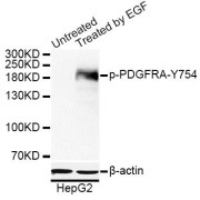 Western blot analysis of extracts of HepG2 cells, using Phospho-PDGFRA-Y754 antibody (abx123317) at 1/1000 dilution. HepG2 cells were treated by EGF (100ng/ml) for 30 minutes after serum-starvation overnight.